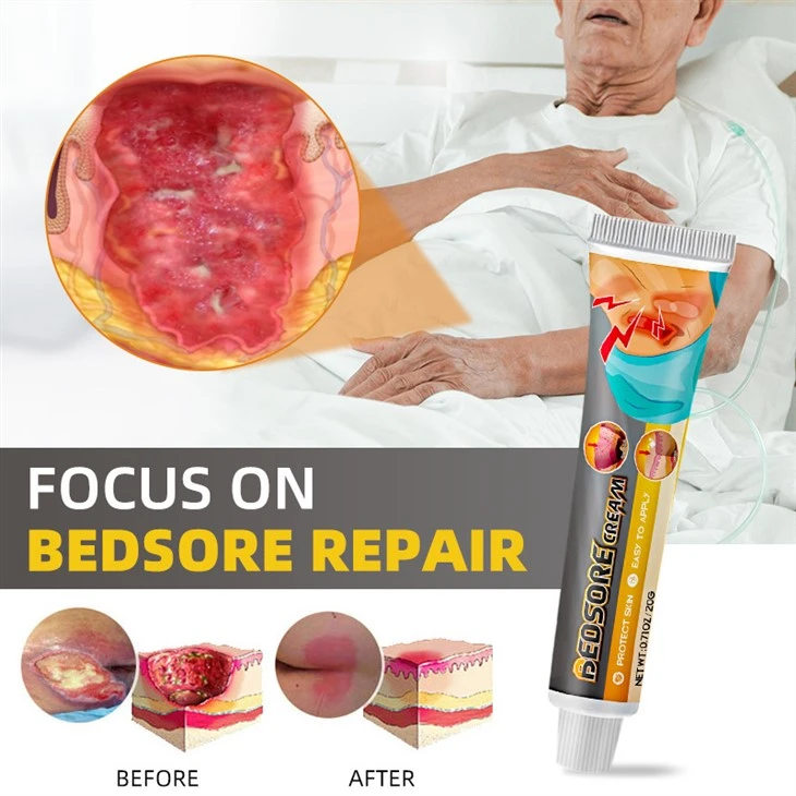 Anti-infection Bedsore Treatment Cream