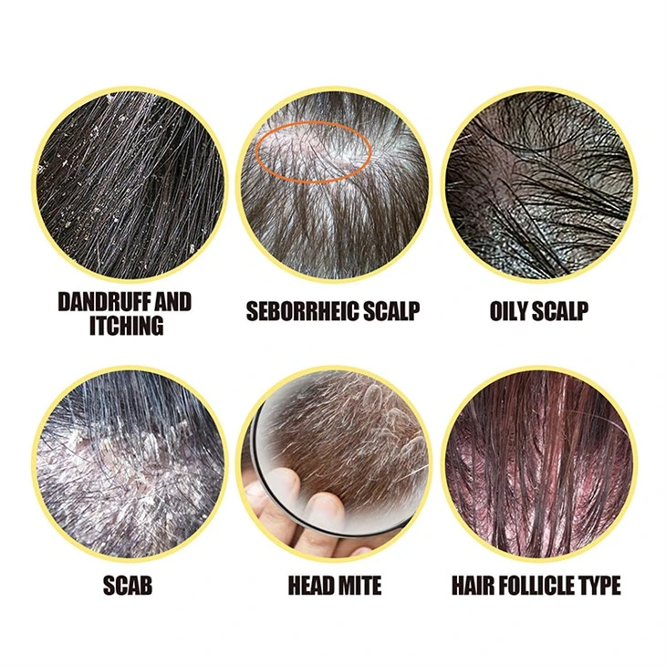 Hair Care Sulfur Massage Shampoo