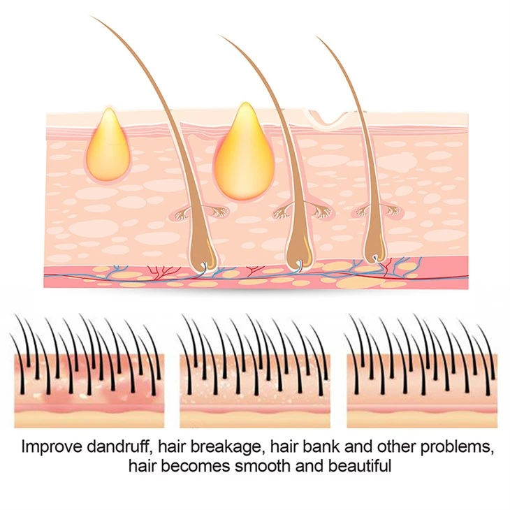Hair Care Sulfur Massage Shampoo